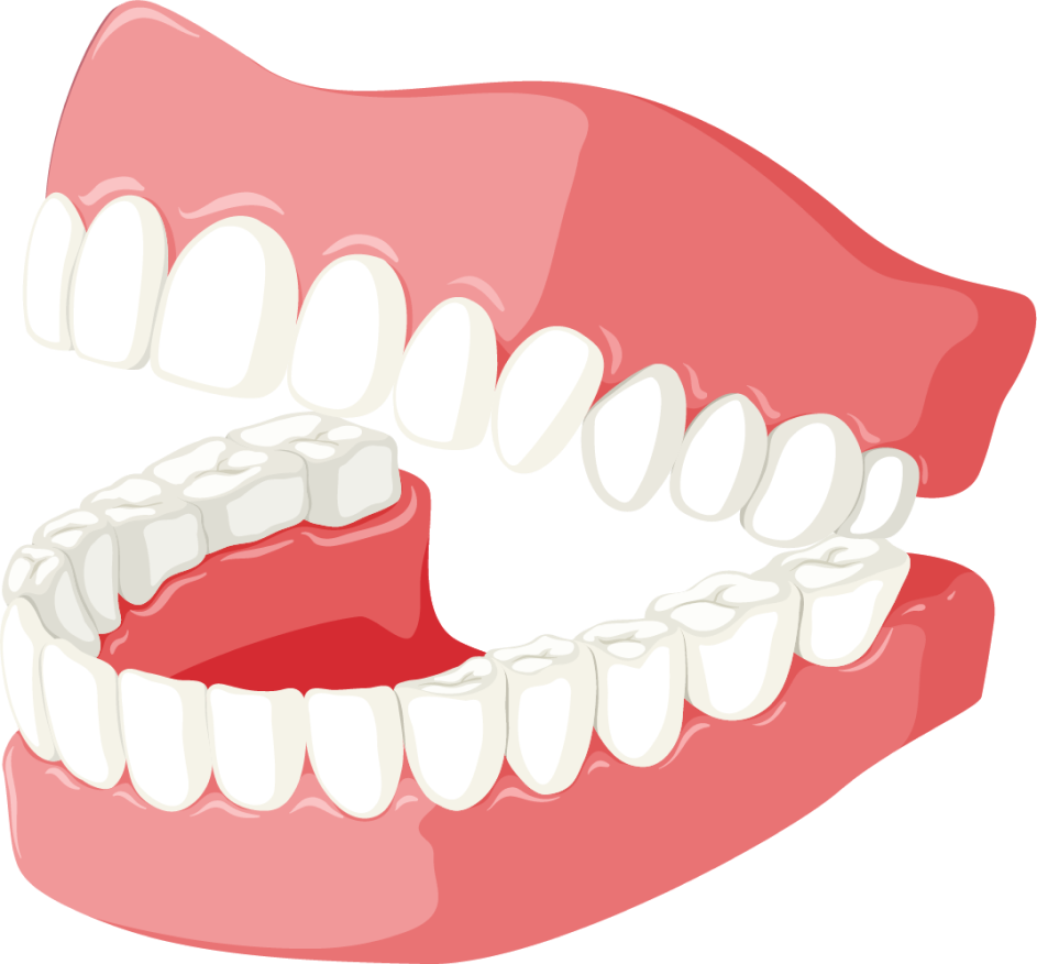 root canal treatment for broken teeth