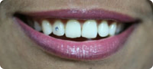 best cosmetic dentists | top cosmetic dentists