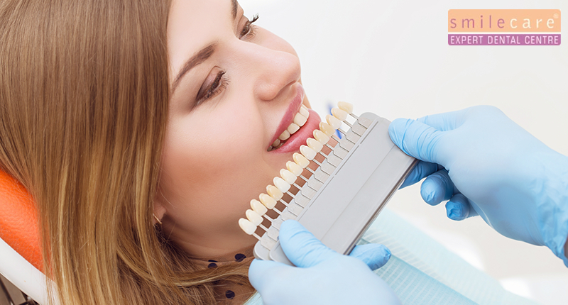 professional teeth whitening | teeth whitening treatment