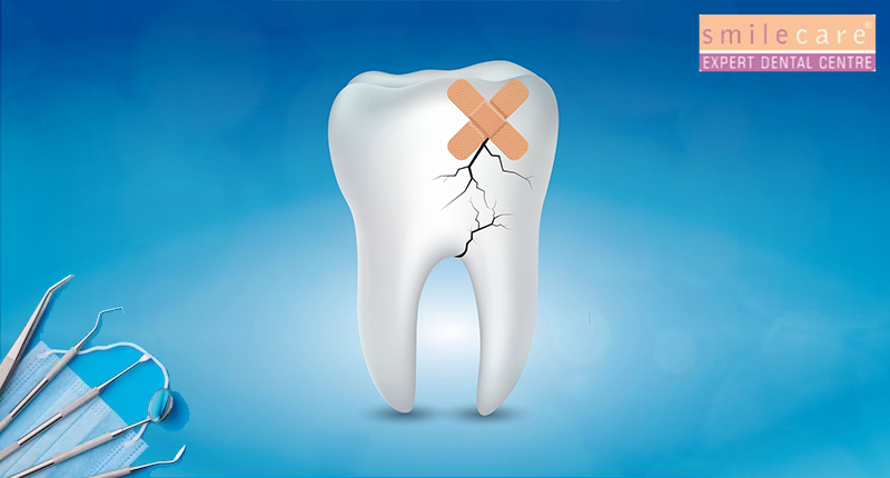 how to fix a cracked tooth pain | treatment for cracked tooth