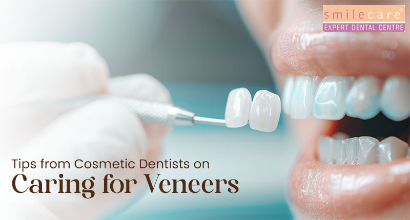 Tips from cosmetic dentists on caring for veneers