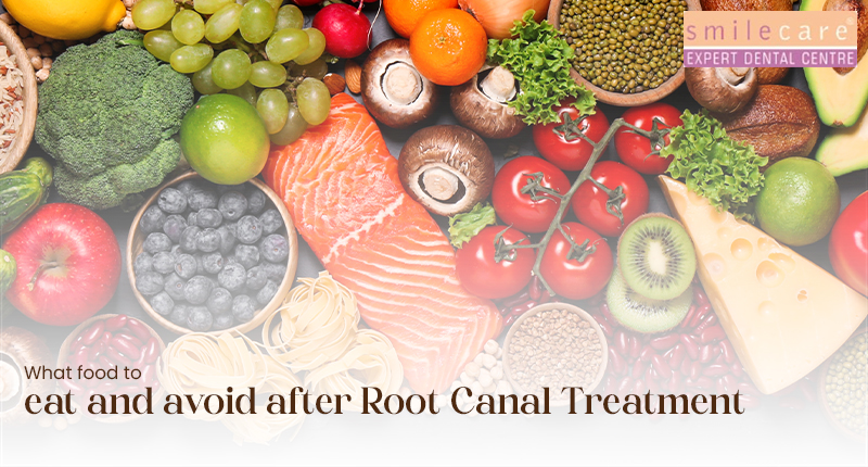 Food to Eat and Avoid After a Root Canal Treatment