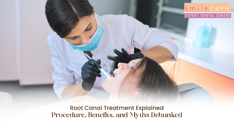 root canal treatment
