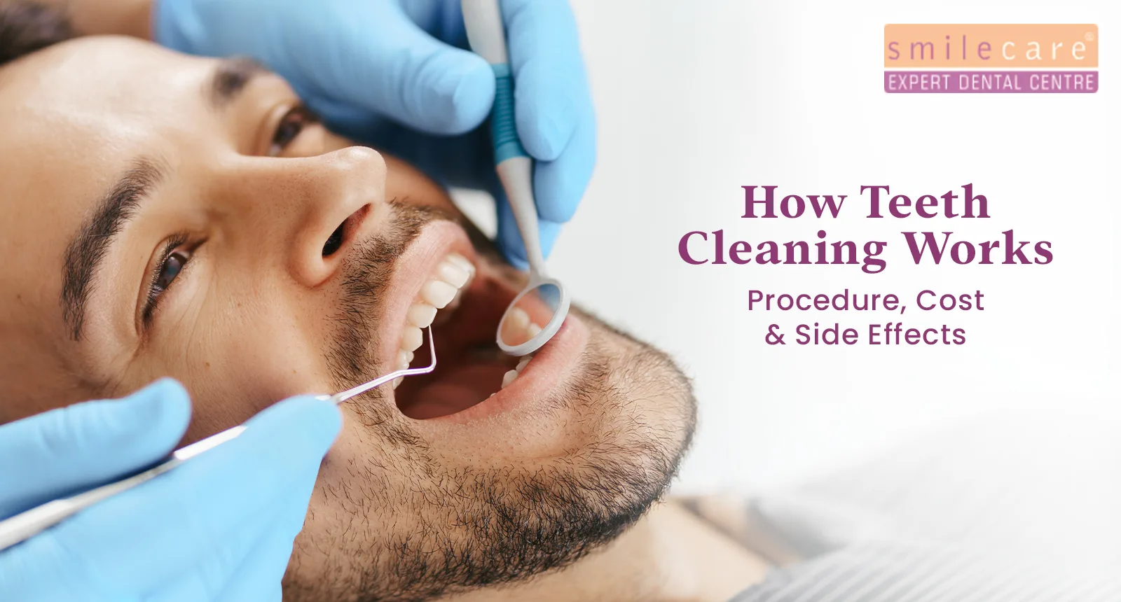 how teeth cleaning works