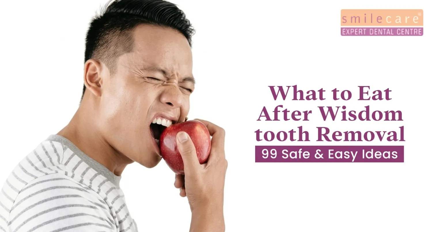 What to eat after wisdom tooth removal